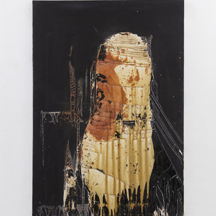 DENIS VOLPIANA | Feto