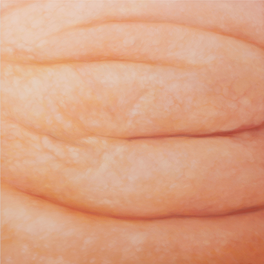 Andrea Schifano | n.5 (serie Skin)