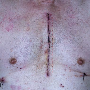 Fabio Dibello | Further Life