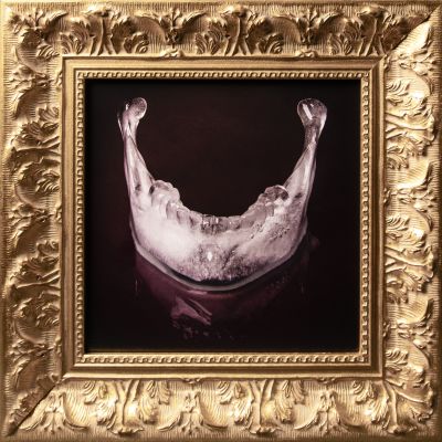  | Memento lower jaw 2